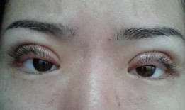 郑州双眼皮爆料案件视频,揭秘整形行业潜规则与维权之路